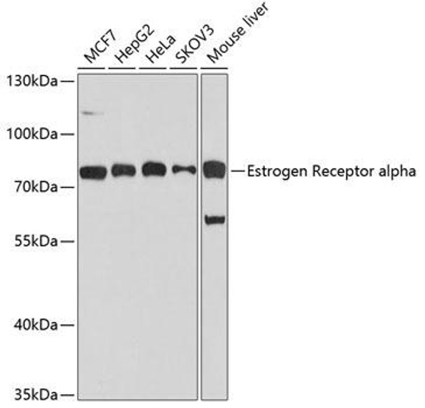 Epigenetics and Nuclear Signaling Antibodies 1 Anti-Estrogen Receptor alpha Antibody CAB0296