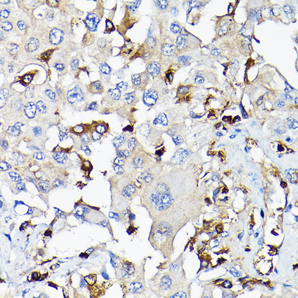 Cell Biology Antibodies 1 Anti-IGF1 Antibody CAB0303