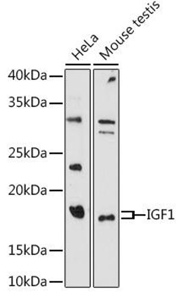 Cell Biology Antibodies 1 Anti-IGF1 Antibody CAB0303