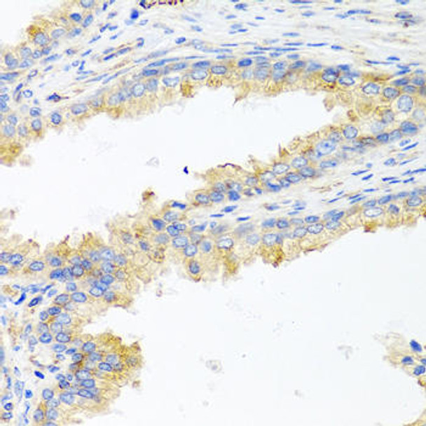 Metabolism Antibodies 1 Anti-APOE Antibody CAB0304