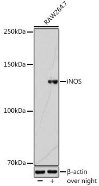 Cell Biology Antibodies 1 Anti-iNOS Antibody CAB0312