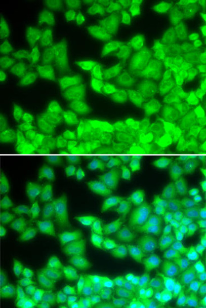 Cell Biology Antibodies 1 Anti-CD40L Antibody CAB0327