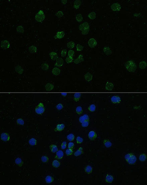 Immunology Antibodies 1 Anti-CD4 Antibody CAB0362