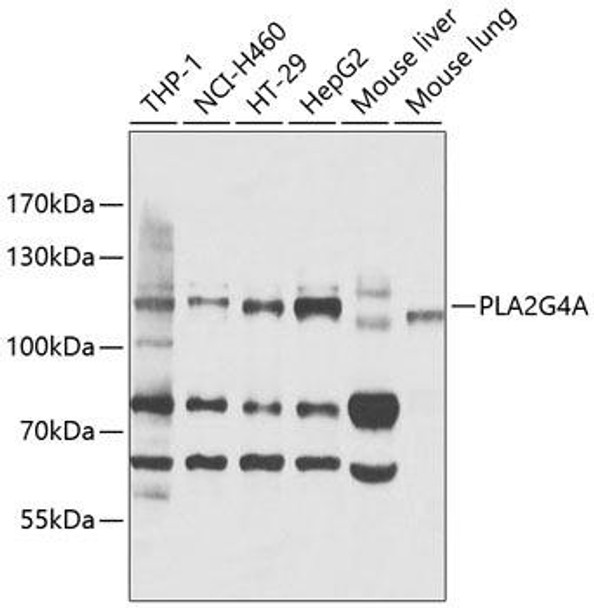 Metabolism Antibodies 1 Anti-PLA2G4A Antibody CAB0394