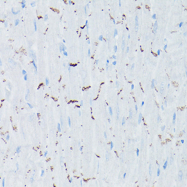 KO Validated Antibodies 1 Anti-N-Cadherin Antibody CAB0432KO Validated