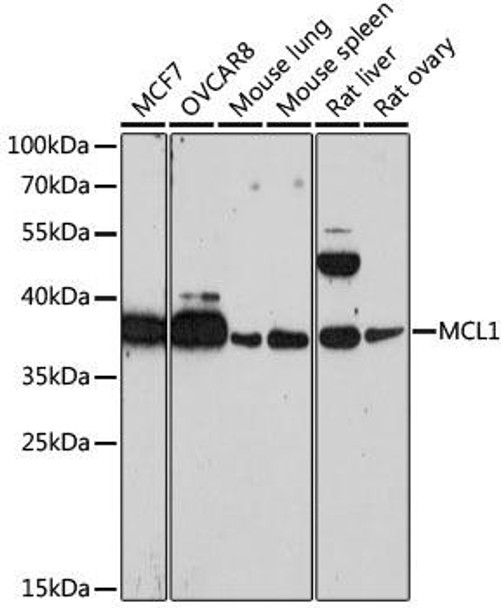 Cell Death Antibodies 1 Anti-MCL1 Antibody CAB0434