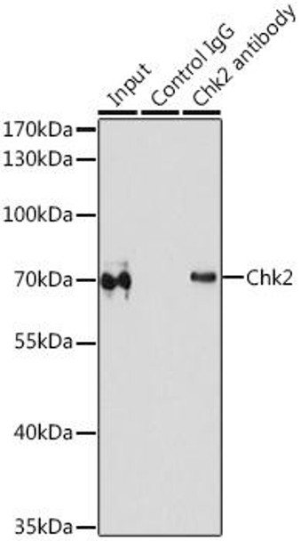 Cell Death Antibodies 1 Anti-Chk2 Antibody CAB0466