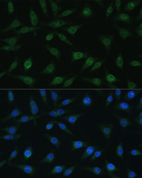 Immunology Antibodies 1 Anti-NUP98 Antibody CAB0530