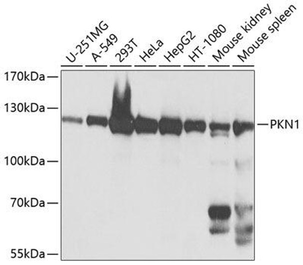 Epigenetics and Nuclear Signaling Antibodies 1 Anti-PKN1 Antibody CAB0553