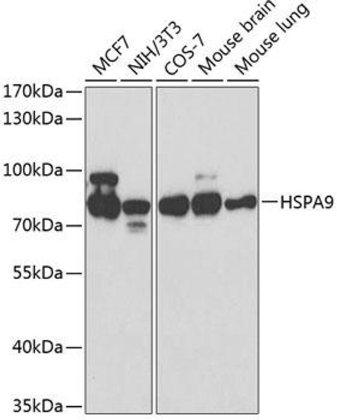 Cell Biology Antibodies 1 Anti-HSPA9 Antibody CAB0558