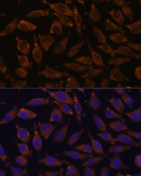 Developmental Biology Anti-NOTCH2 Antibody CAB0560