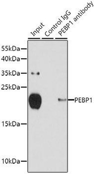 Cell Biology Antibodies 1 Anti-PEBP1 Antibody CAB0578