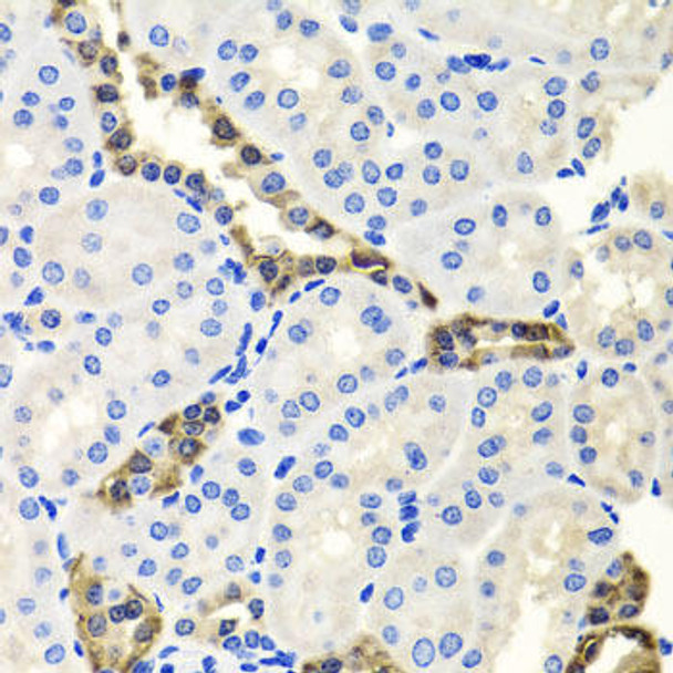 Cell Biology Antibodies 1 Anti-Endo G Antibody CAB0604