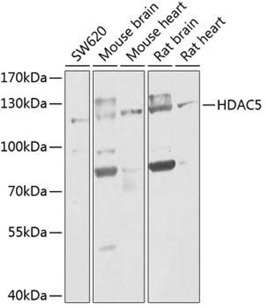 Epigenetics and Nuclear Signaling Antibodies 1 Anti-HDAC5 Antibody CAB0632