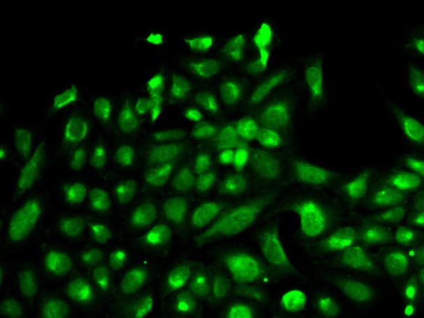 Cell Biology Antibodies 1 Anti-SPHK1 Antibody CAB0660