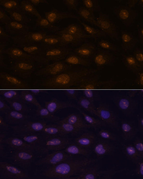 Developmental Biology Anti-MYOD1 Antibody CAB0671