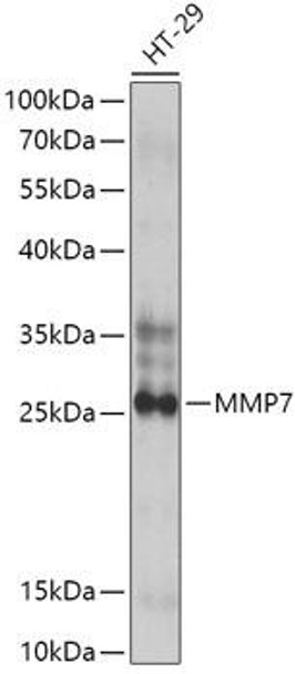 Cell Biology Antibodies 1 Anti-MMP7 Antibody CAB0695