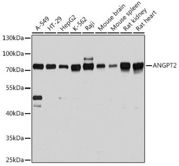 Cardiovascular Antibodies Anti-ANGPT2 Antibody CAB0698