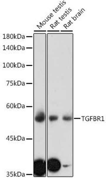 Cell Death Antibodies 1 Anti-TGFBR1 Antibody CAB0708