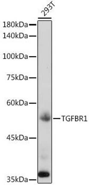 Cell Death Antibodies 1 Anti-TGFBR1 Antibody CAB0708