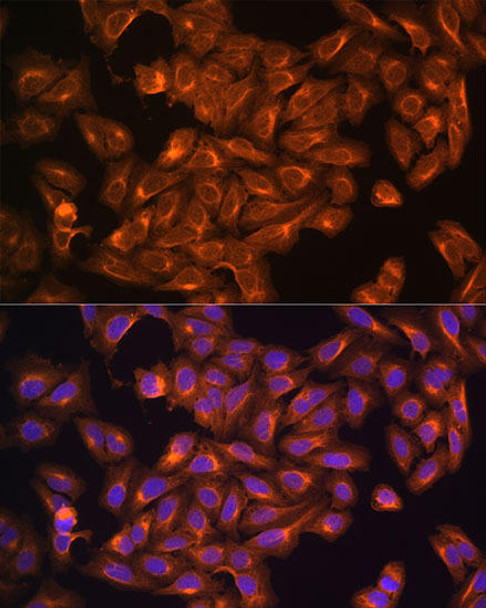 KO Validated Antibodies 1 Anti-NF2 Antibody CAB0739KO Validated