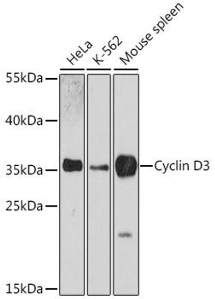 KO Validated Antibodies 1 Anti-Cyclin D3 Antibody CAB0746KO Validated