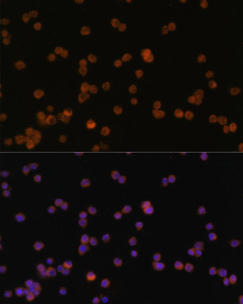 Immunology Antibodies 1 Anti-JAK3 Antibody CAB0748