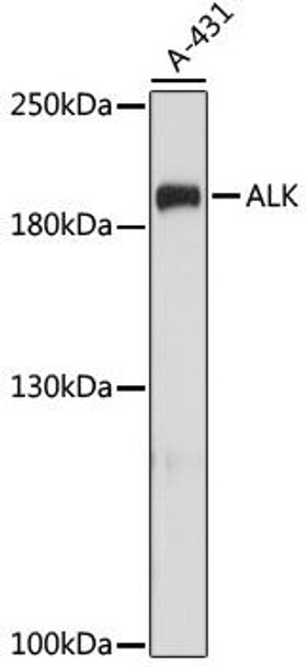 Cell Biology Antibodies 1 Anti-ALK Antibody CAB0766