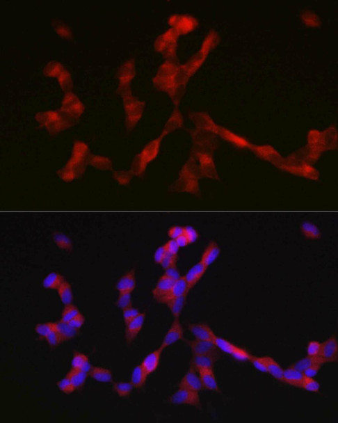 Cell Biology Antibodies 1 Anti-ALK Antibody CAB0766