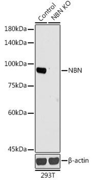 KO Validated Antibodies 1 Anti-NBN Antibody CAB0783KO Validated