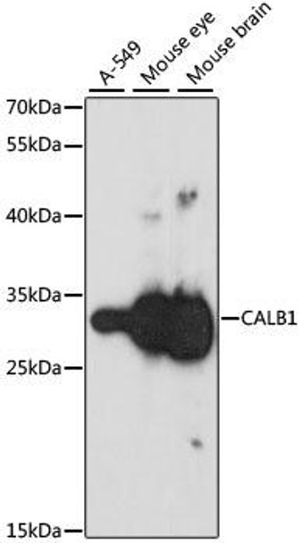 Cell Biology Antibodies 1 Anti-CALB1 Antibody CAB0802