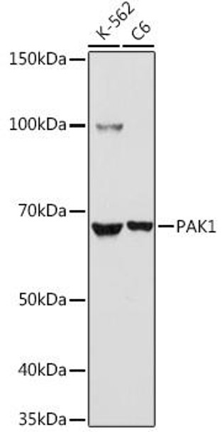 Cell Death Antibodies 1 Anti-PAK1 Antibody CAB0809