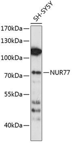 Epigenetics and Nuclear Signaling Antibodies 1 Anti-NUR77 Antibody CAB0843