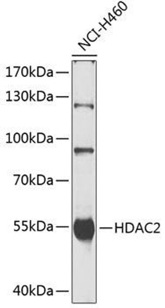 Cell Biology Antibodies 1 Anti-HDAC2 Antibody CAB0867