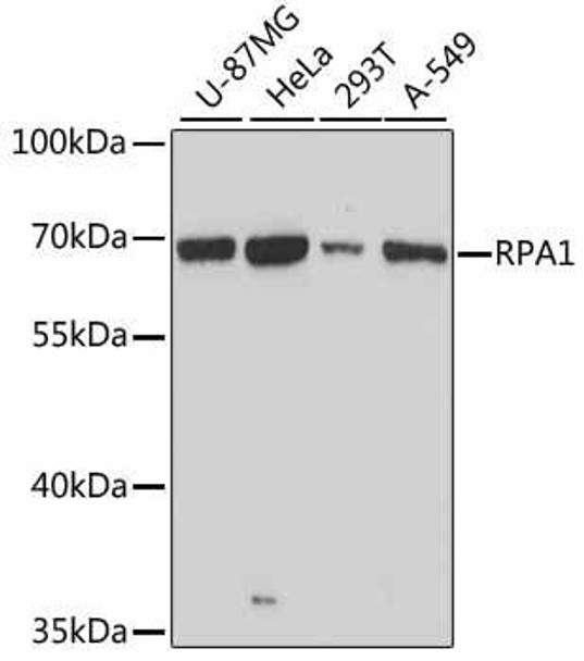 Epigenetics and Nuclear Signaling Antibodies 1 Anti-RPA1 Antibody CAB0874