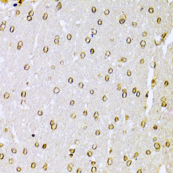 Epigenetics and Nuclear Signaling Antibodies 1 Anti-KU70 Antibody CAB0883