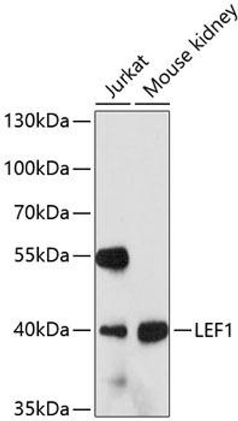 ChIP Antibodies Anti-LEF1 Antibody CAB0909