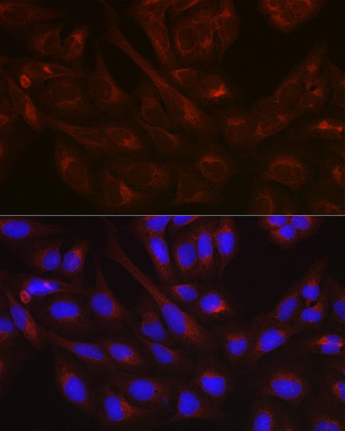 Cell Biology Antibodies 1 Anti-NSF Antibody CAB0926