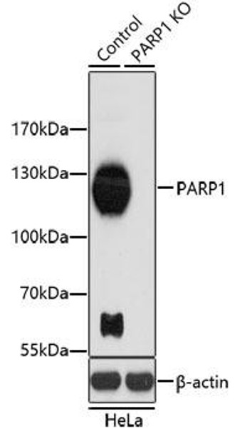 KO Validated Antibodies 1 Anti-PARP1 Antibody CAB0942KO Validated