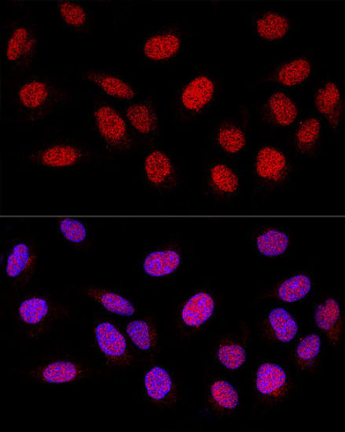 KO Validated Antibodies 1 Anti-PARP1 Antibody CAB0942KO Validated