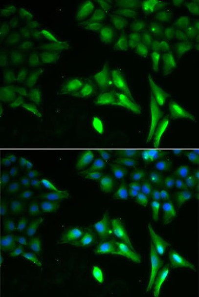 Metabolism Antibodies 1 Anti-ACADS Antibody CAB0945