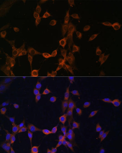 Cell Biology Antibodies 1 Anti-PPP3R1 Antibody CAB0954