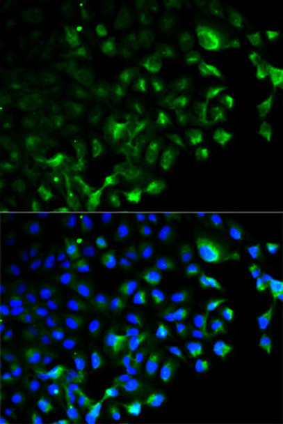 KO Validated Antibodies 1 Anti-TRAF2 Antibody CAB0962KO Validated