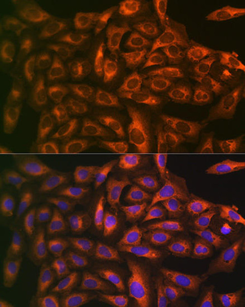 Cell Death Antibodies 1 Anti-Caspase-1 Antibody CAB0964