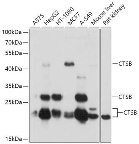 Cell Biology Antibodies 1 Anti-CTSB Antibody CAB0967