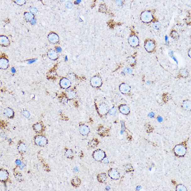 Cell Biology Antibodies 1 Anti-CTSB Antibody CAB0967