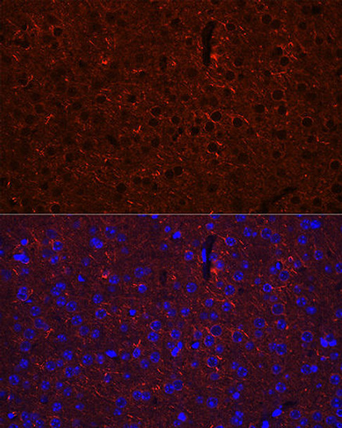 Neuroscience Anti-GAD2 Antibody CAB0971