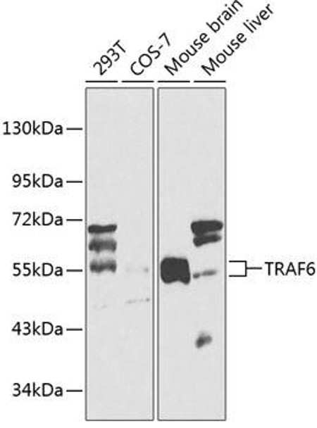 Epigenetics and Nuclear Signaling Antibodies 1 Anti-TRAF6 Antibody CAB0973