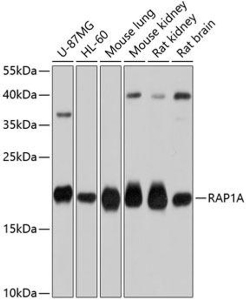 Neuroscience Anti-RAP1A Antibody CAB0975