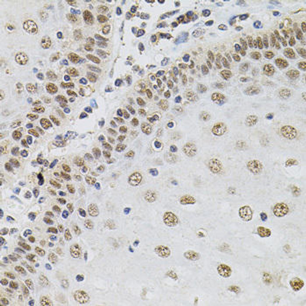 Cell Biology Antibodies 1 Anti-TGM2 Antibody CAB0981